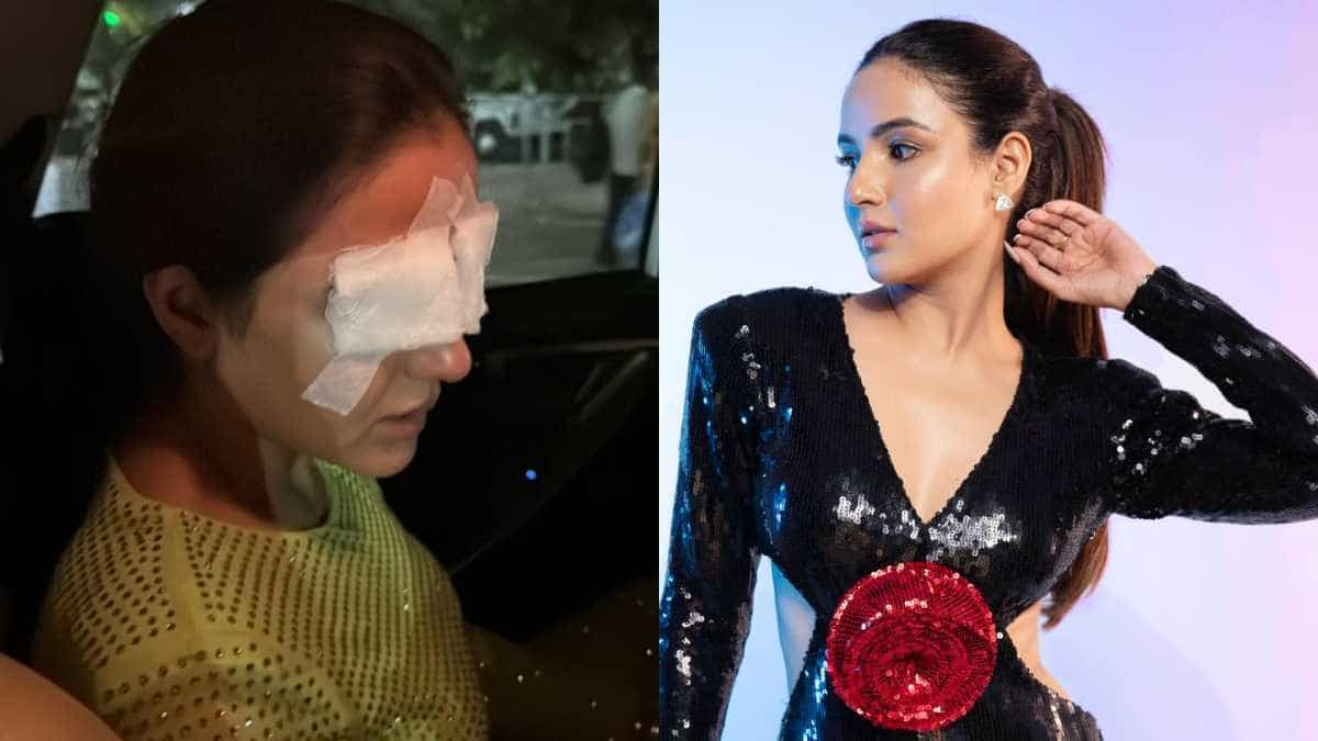 Jasmin Bhasin's eyes bandaged after she suffers corneal injury | Here's what happened