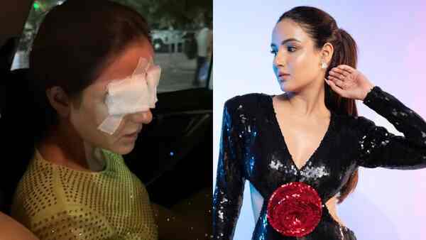 Jasmin Bhasin's eyes bandaged after she suffers corneal injury | Here's what happened