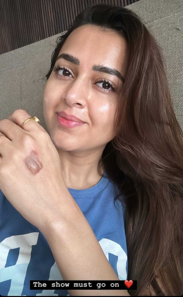 Tejasswi Prakash gets injured.