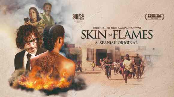 Skin In Flames