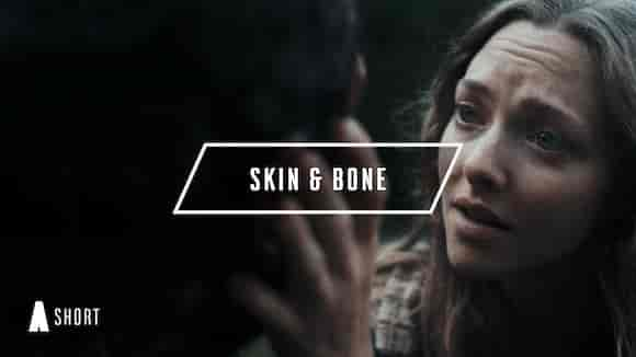 Skin & Bone