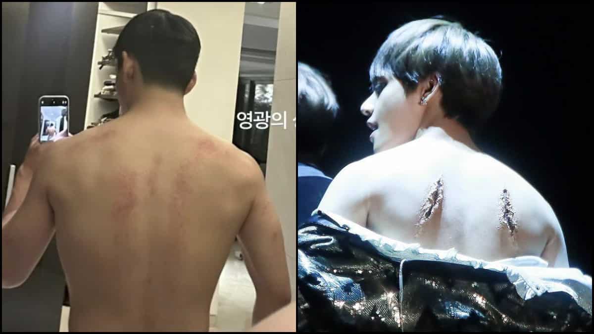 BTS' V shows the wounds on his back, ARMY recall Kim Taehyung's 'Blood, Sweat, & Tears' performance