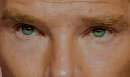 Benedict Cumberbatch has an eye condition called heterochromia, which means that he has more than one ______ in his eyes. Fill in the blank.							