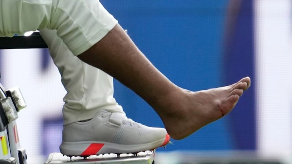 There was a big cut on the right foot of Rishabh Pant after the injury.