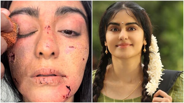 The Kerala Story: Adah Sharma reveals how her bruised and wounded face makeup was done, shares 'shocking' pictures