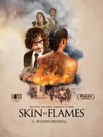 Skin In Flames
